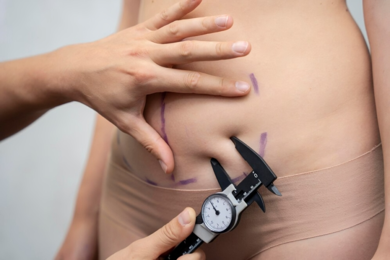 tummy tuck scars